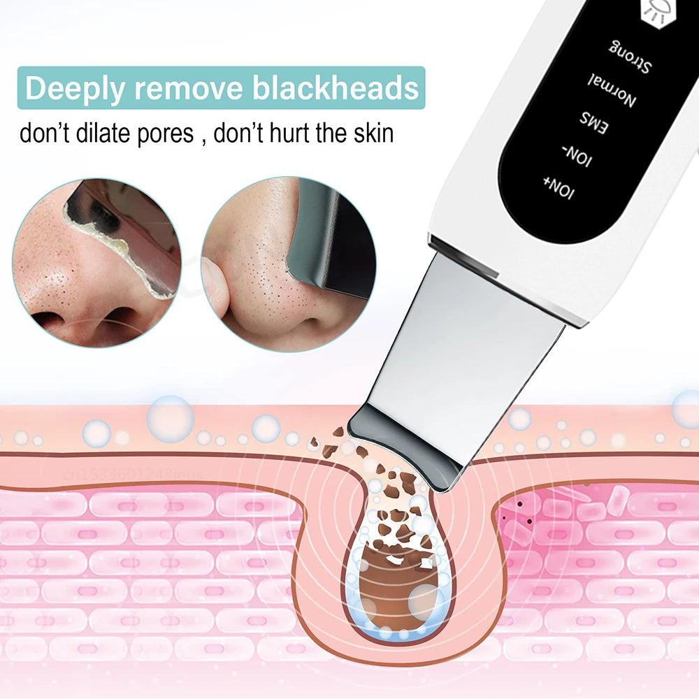 Ultrasonic Skin Scrubber - Pure™