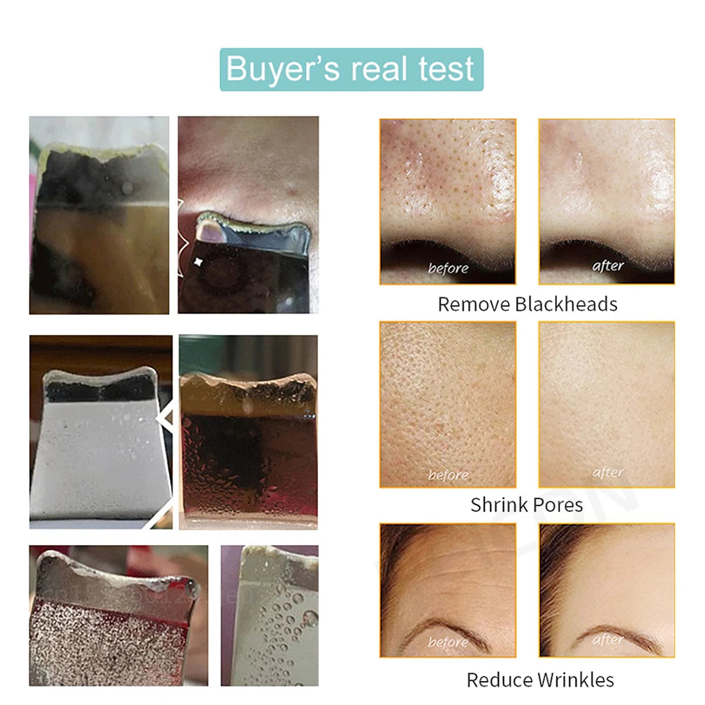 Ultrasonic Skin Scrubber - Pure™